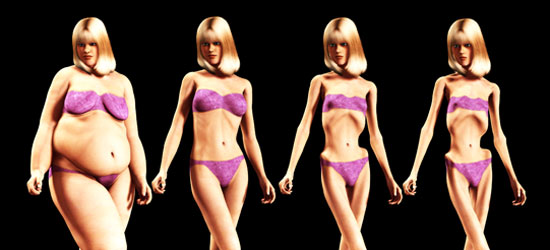 Simulación de pérdida de peso en mujer con anorexia o bulimia